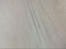 300人の腋 2　サンプル画像04